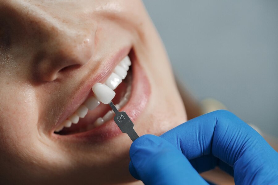 Dental Implants Treatment In Pimple Saudagar, Sangavi, Wakad, Baner, Balewadi